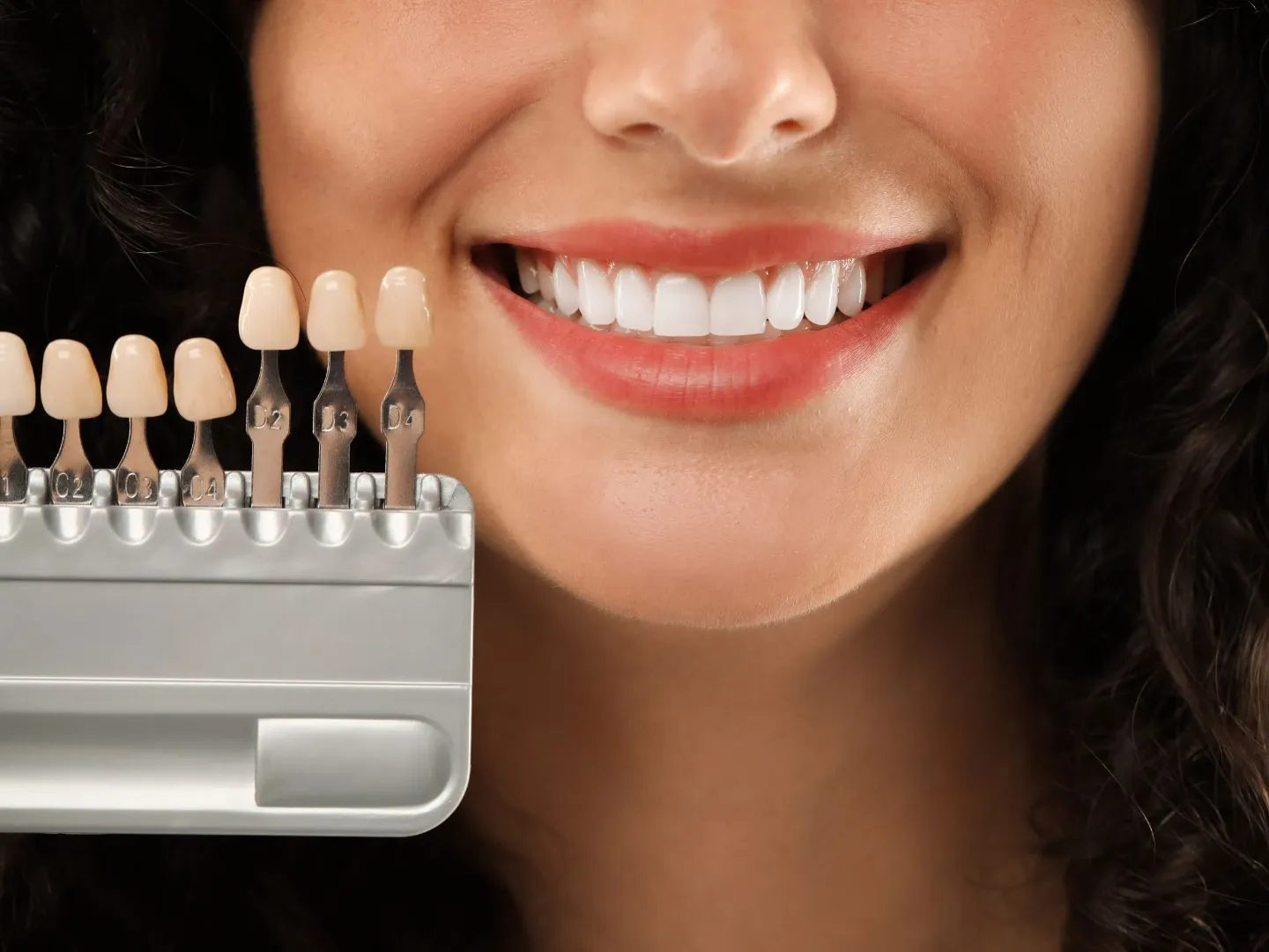 Carillas dentales de porcelana