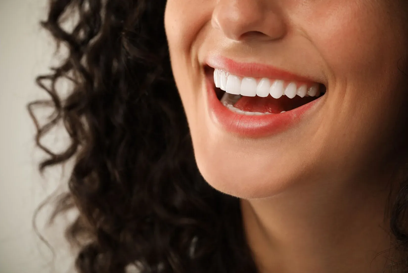 Resultado de sonrisa natural y armónica